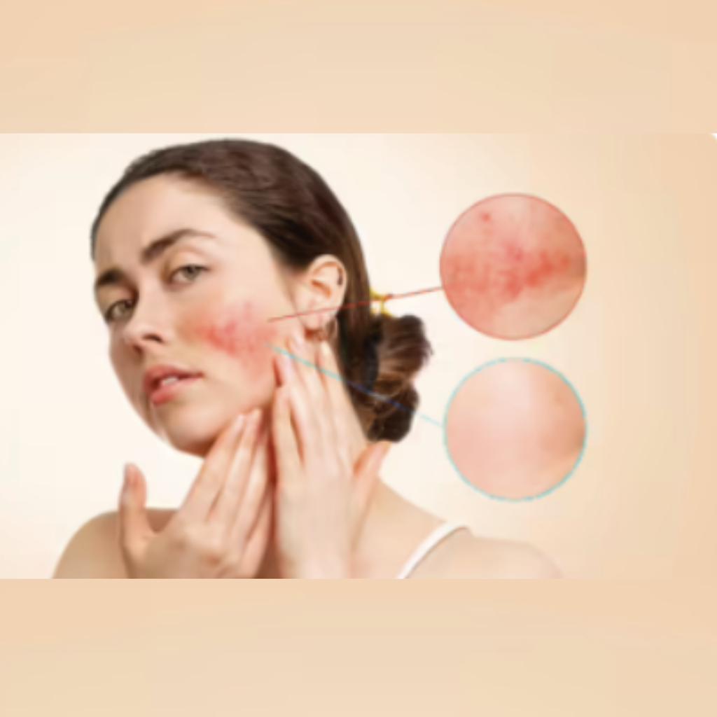 Gel pentru regenerării pielii, HERMO®Gel